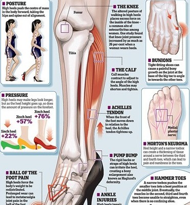 双语：浑身酸痛小心高跟鞋“杀手”